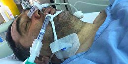 وضعیت نگرانکننده مداح جانبازی که در کماست